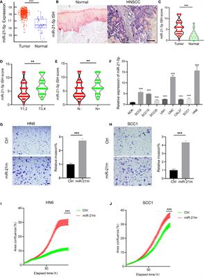 A Super-Enhancer Driven by FOSL1 Controls miR-21-5p Expression in Head and Neck Squamous Cell Carcinoma